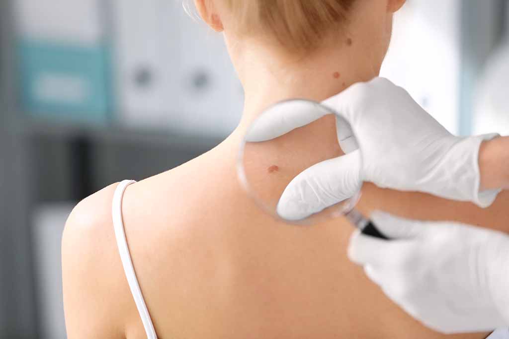 Qual è la correlazione tra malattie della pelle e lavoro?